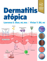 DERMATITIS ATOPICA - 9788413824413